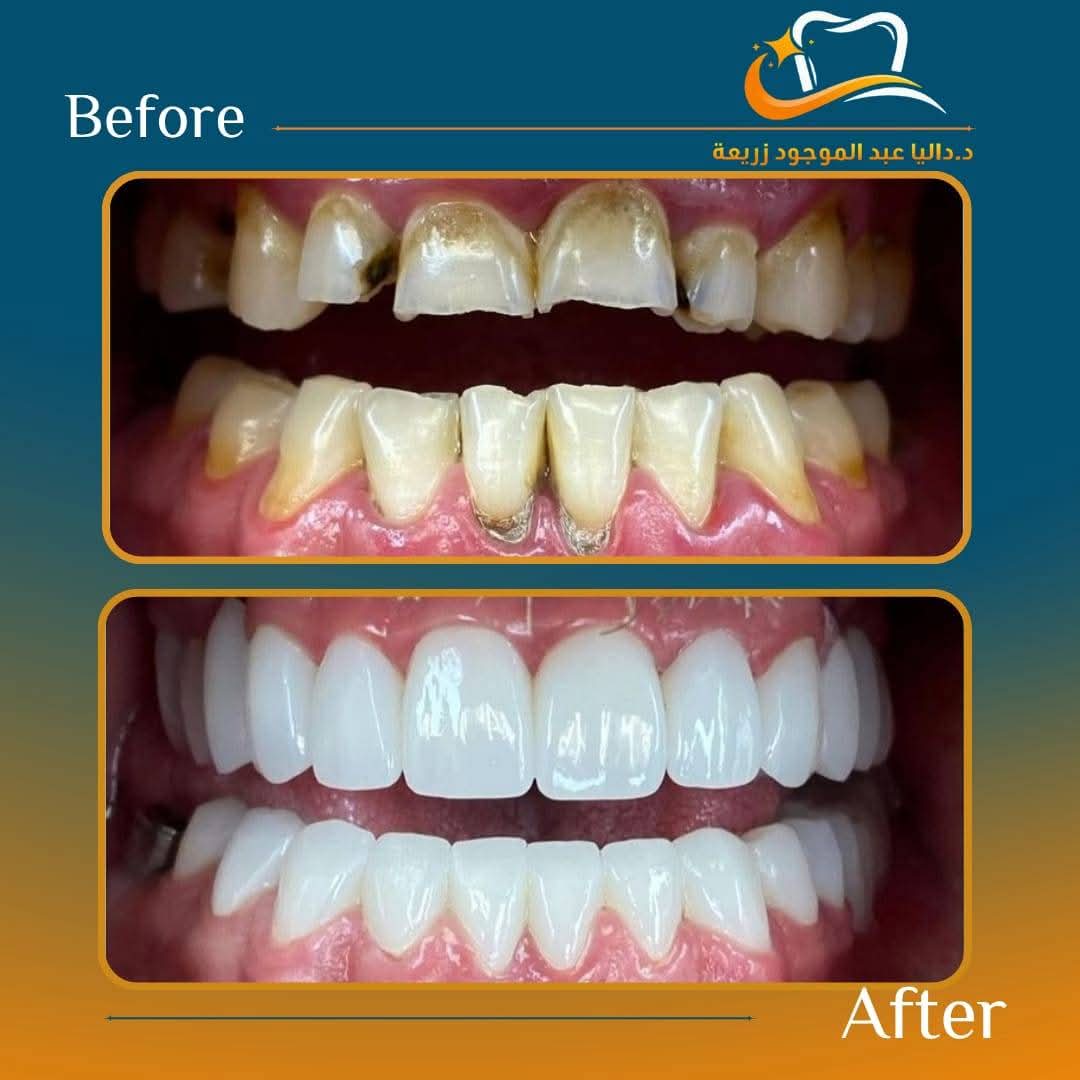 Cosmetic Treatment